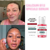 Facial Skin Care Essence Delicate Pores Moisturizing Nourish Dull Hydrating Protecting Skin Bright Revitalizing Unisex Essence