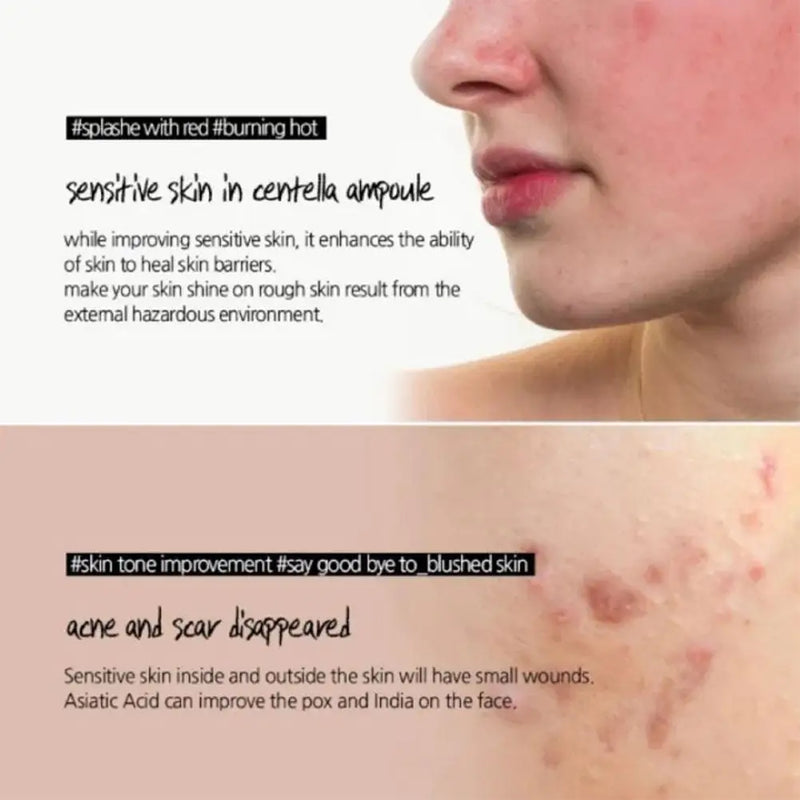 Skin1004 Centella Brightening Serum