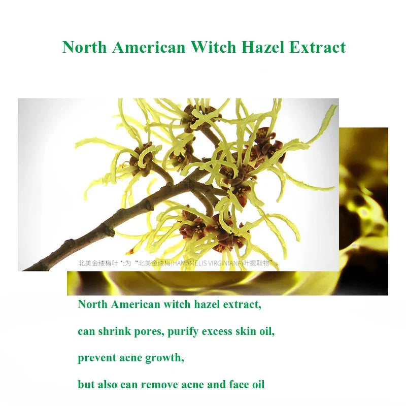 HerbalClear Acne Treatment Cream