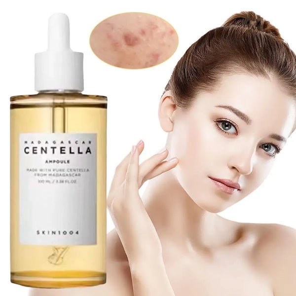 Skin1004 Centella Brightening Serum