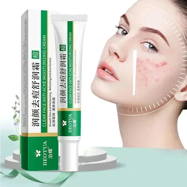 HerbalClear Acne Treatment Cream